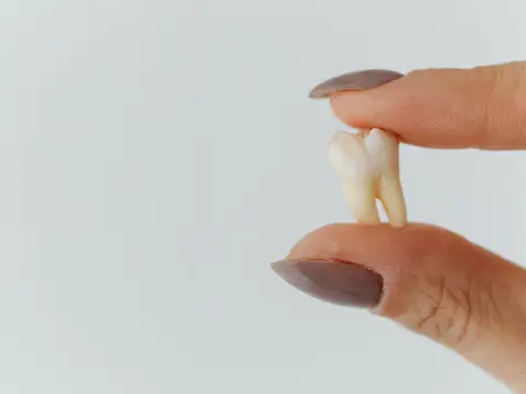 Rêver de dents qui tombent