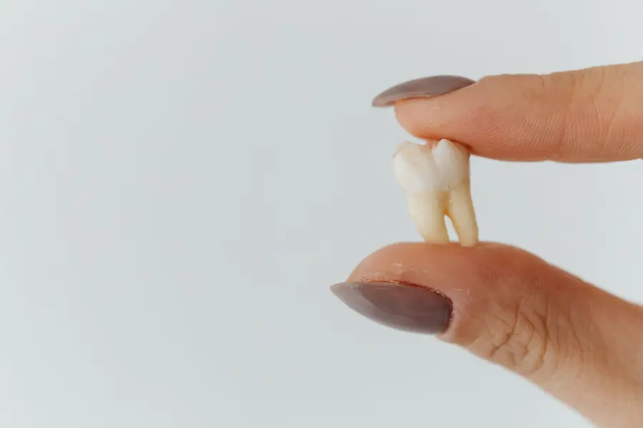 Rêver de dents qui tombent